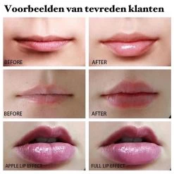 BenjaBeauty Lip Plumper - Lippen - Lipstick - Lippenbalsem - Rood - Wit -Mode-Cosmetica Winkel 1200x1200 860